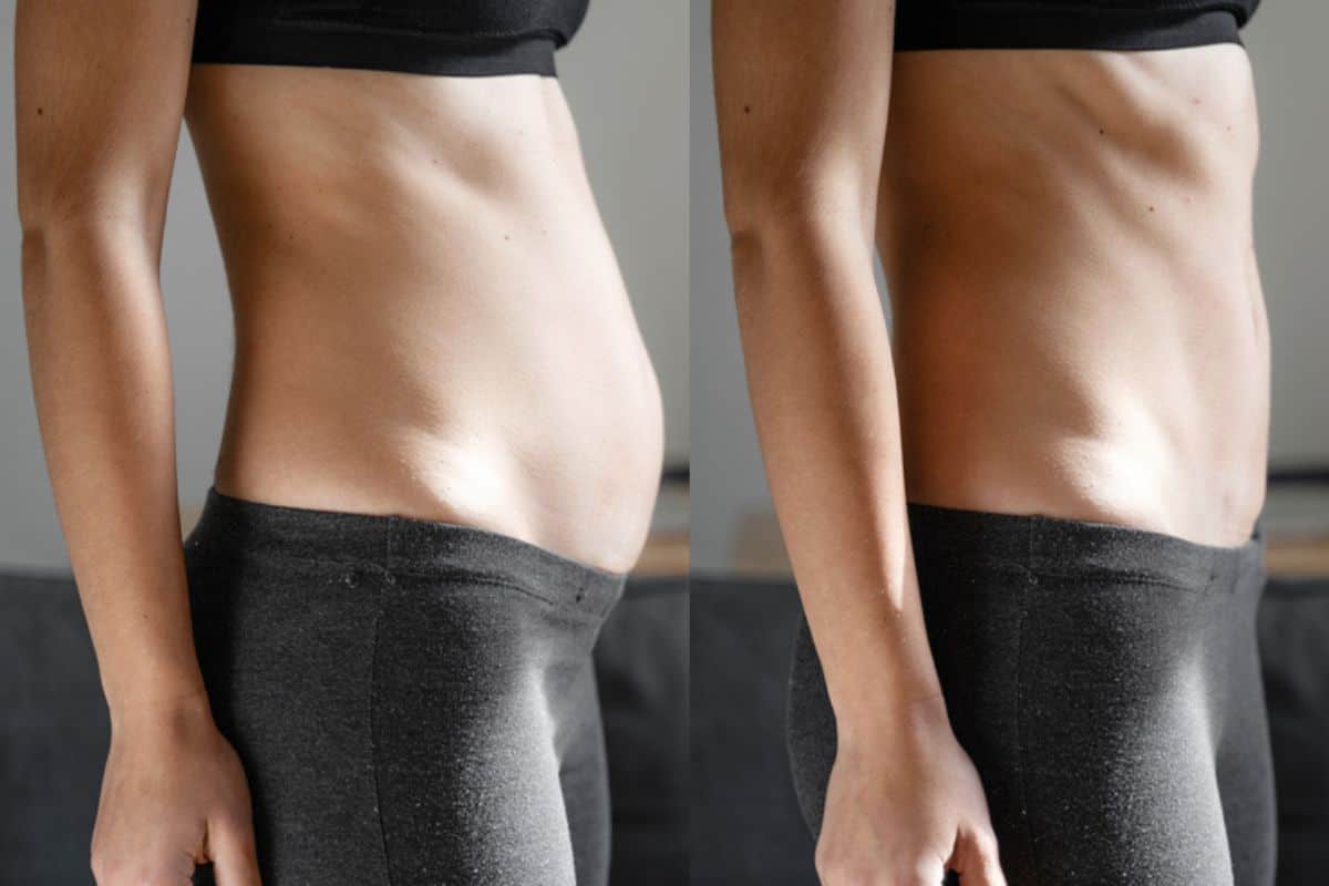 Post-Pregnancy: What Happens to Your Abdominal Muscles After Birth Hertfordshire