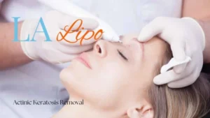 Woman receiving Actinic Keratosis Removal Treatment Hertfordshire