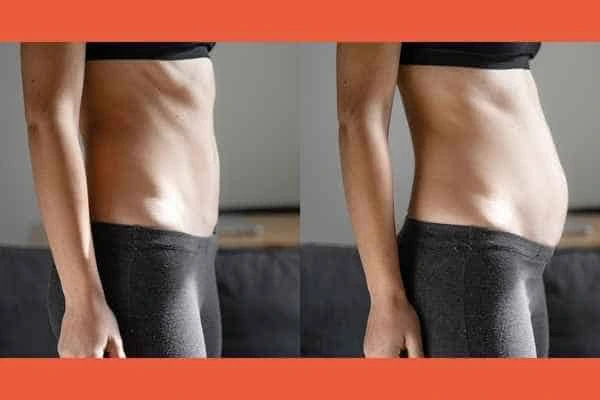 LA-EMS Body Sculpting results Hertfordshire