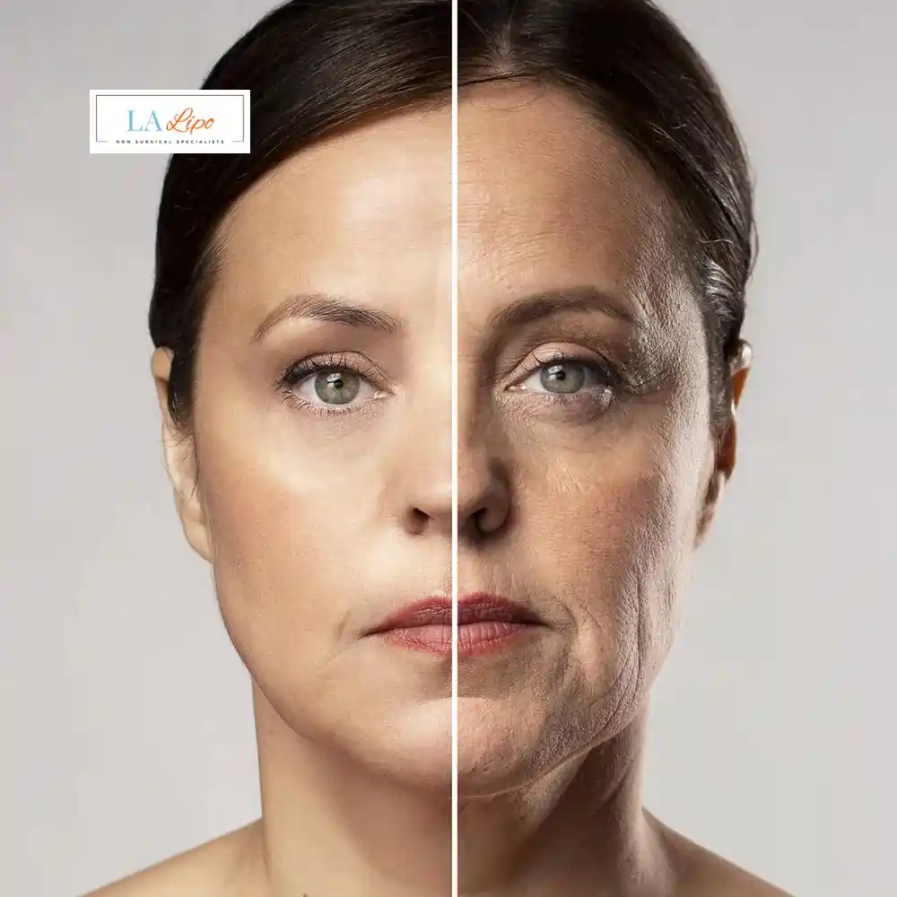 How Can You Tell If Non-Surgical Skin Tightening Is Right for You Hertfordshire?