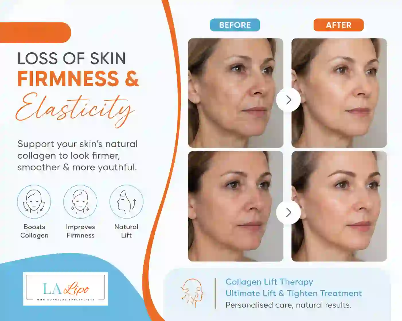 Sign #7: Loss of Skin Firmness and Elasticity Hertfordshire